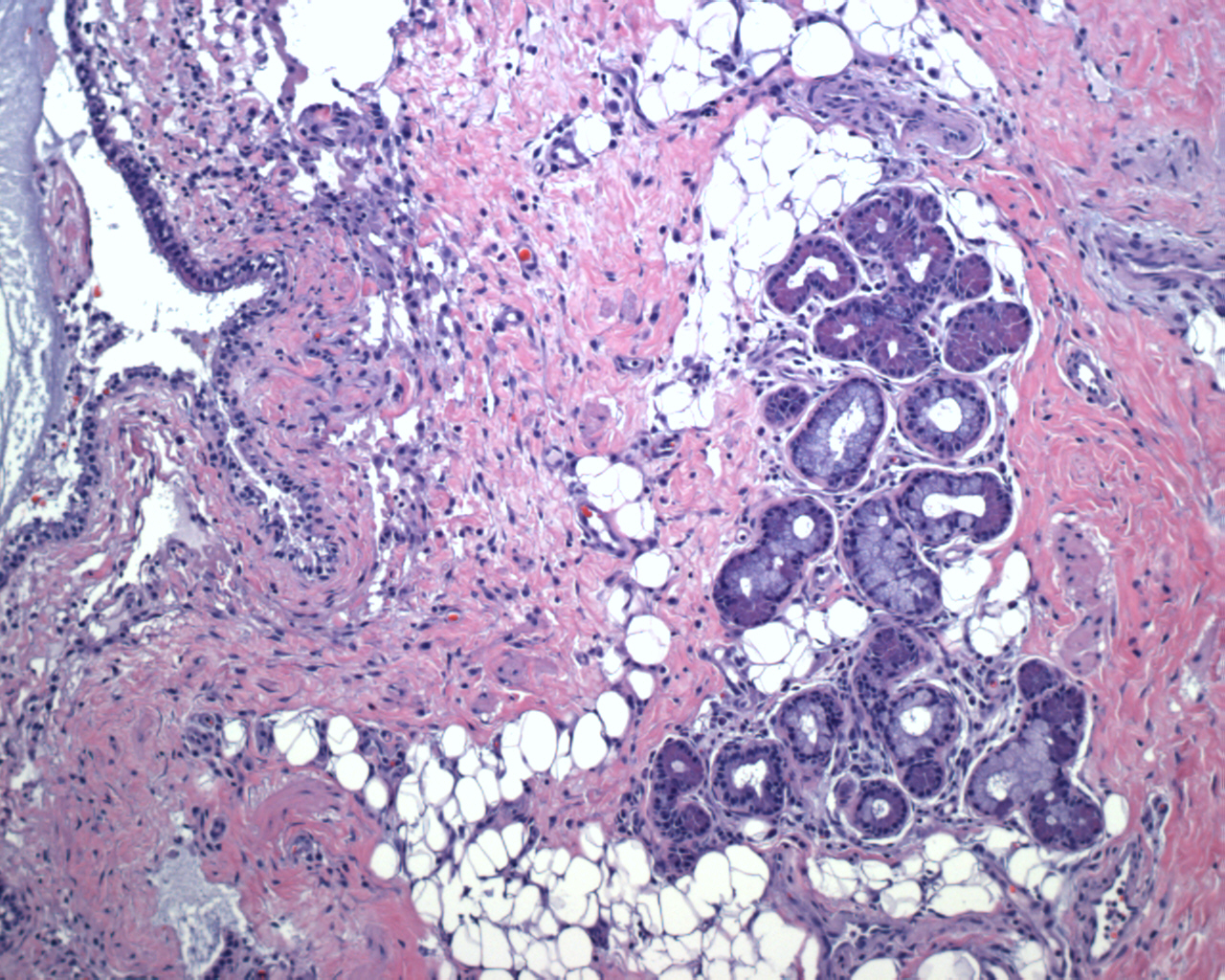 Pathology Image